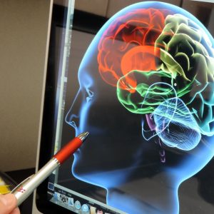 https://wbhm.org/wp-content/uploads/2019/10/Brain_image_close-up-300x300.jpg