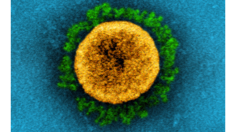 Transmission electron micrograph of a SARS-CoV-2 virus particle. The prominent green projections seen on the outside of the yellow virus particle are spike proteins. This fringe of proteins enables the virus to attach to and infect host cells and then replicate.