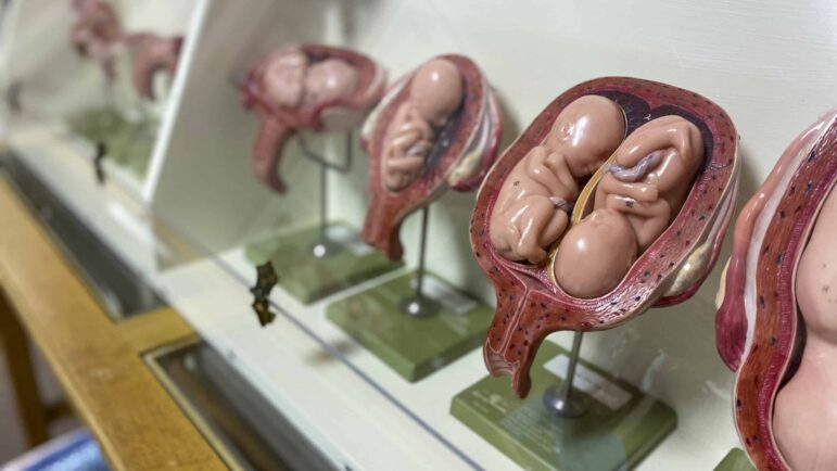 A diagram of a fetus in growth is displayed on June 13, 2022, at Birthright of Jackson, a pregnancy resource center in Mississippi.