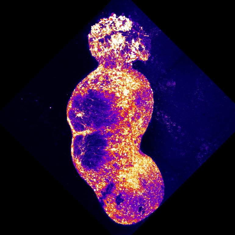 Researchers created an assembloid by integrating four organoids that represent the four components of the human sensory pathway, along which pain stimuli signals are conveyed to the brain. Stimulation of the sensory organoid (top) by pain-inducing substances, such as capsaicin, triggers neuronal activity in that organoid which is then transmitted to the adjacent spinal-cord organoid, the thalamic organoid and, finally, to the cortical organoid (bottom)