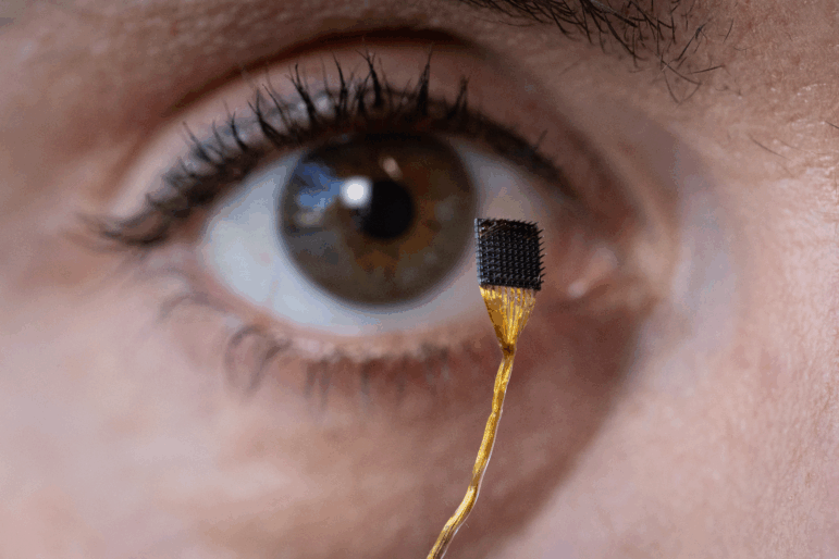 Postdoctoral researcher Erin Kunz holds up a microelectrode array that can be placed on the brain's surface as part of a brain-computer interface.