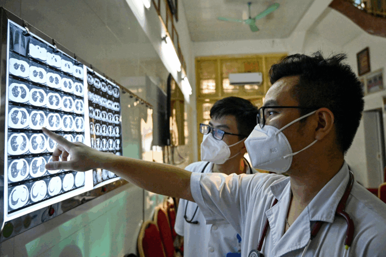 On April 2, 2024, Vietnamese doctor Truong Duc Thai and his colleague check X-ray film of a drug-resistant tuberculosis patient at National Lung Hospital in Hanoi. A faster and vastly more effective treatment for drug-resistant tuberculosis is being rolled out in the Asia-Pacific region, raising hopes of a "new era" in tackling one of the world's deadliest infectious diseases.