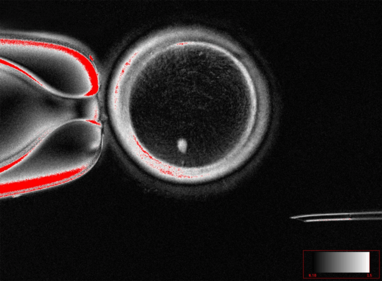 This image shows a human egg after its original DNA has been replaced with DNA from an adult skin cell.