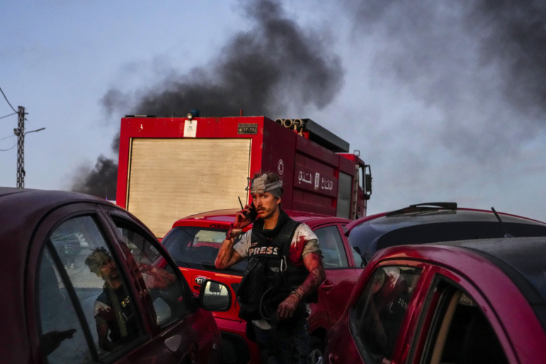 AFP camera operator Dylan Collins speaks on his mobile phone after he got injured by Israeli shelling, at Alma al-Shaab border village with Israel, south Lebanon on Oct. 13, 2023. An Israeli shell landed in a gathering of international journalists covering clashes on the border in south Lebanon, killing one and leaving six others injured.