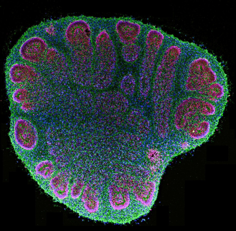 Cross-section of a two-month old cerebral organoid observed under a fluorescence microscope.