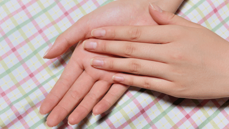 "Healthy nails should be firm. They should not be soft. They should be shiny. They can have some lines in them, but they should generally be very smooth," says dermatologist Dr. Shari Lipner.